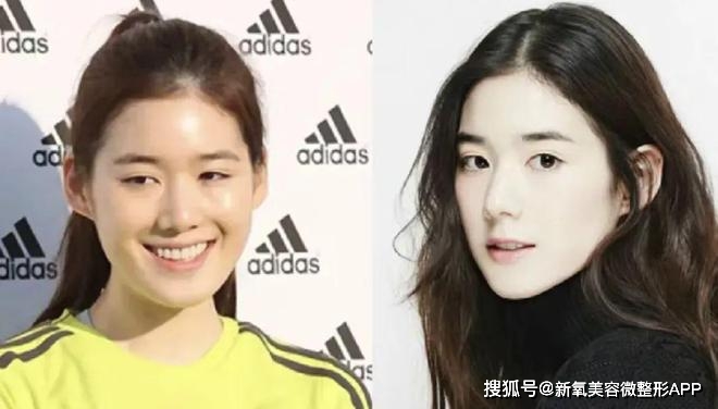 额头窄颧骨高的女明星_韩素希骨相美女_韩素希高颧骨审美